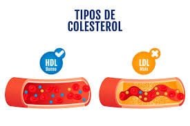 colesterol alto