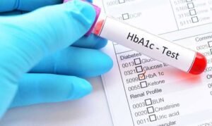 ¿Qué es la HbA1c?
