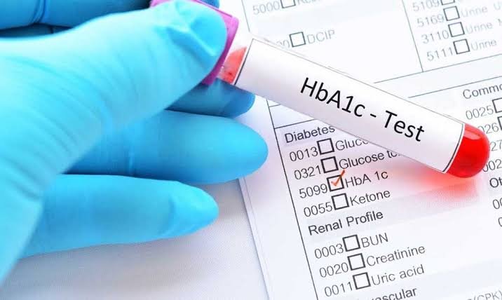 ¿Qué es la HbA1c?